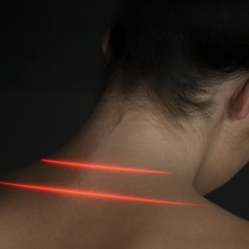 Chiropractic Harrisburg NC Laser Therapy